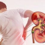 thận yếu có ảnh hưởng đến tinh trùng