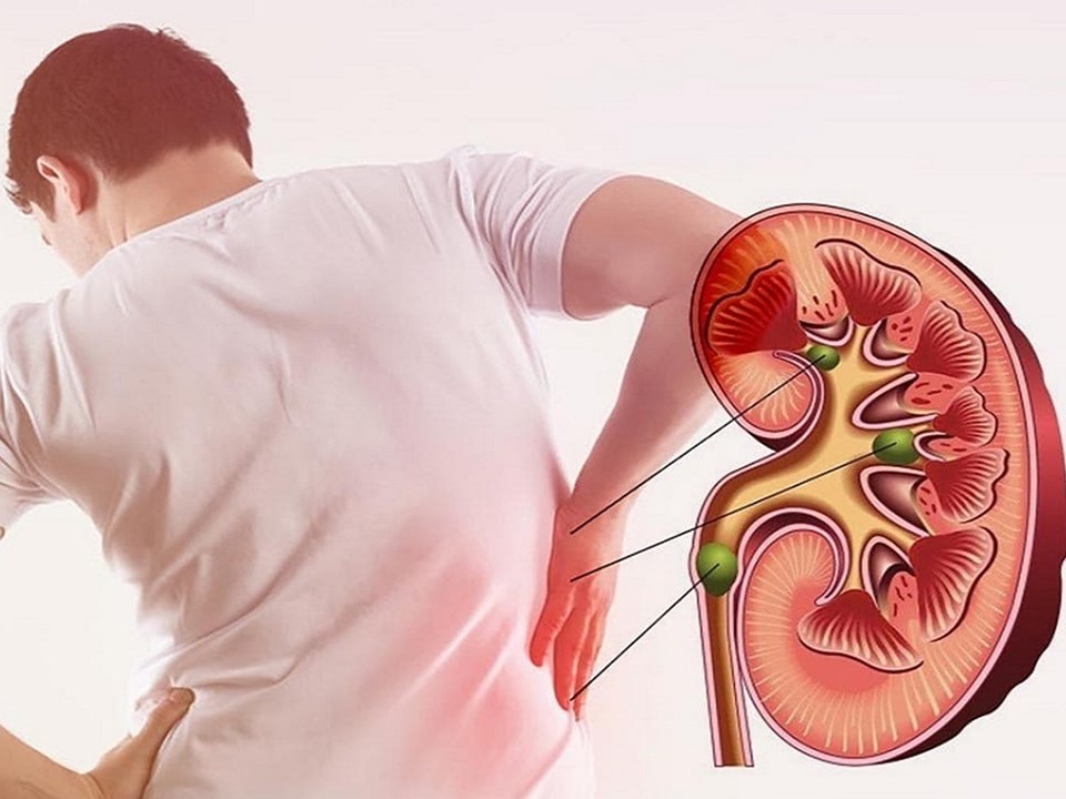 thận yếu có ảnh hưởng đến tinh trùng